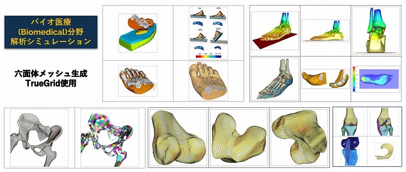 バイオメカニクス解析の応用事例