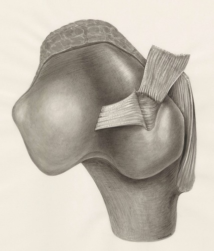医療機器とスポーツ用品のバイオメカニクス解析